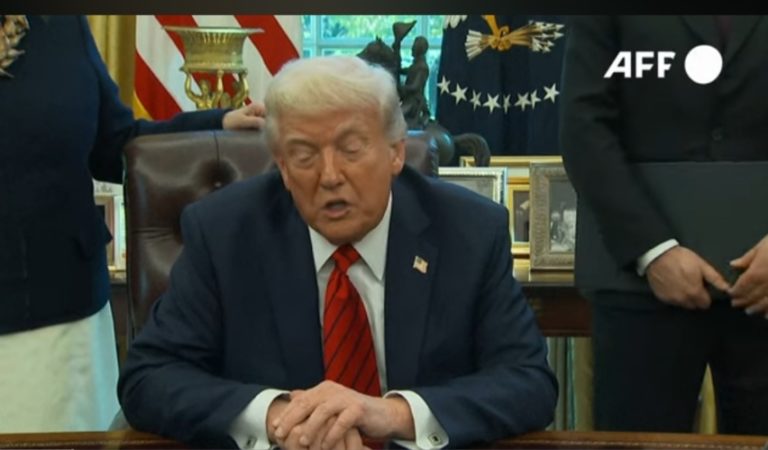 Trump’s Hand Bruise Seems To Appear Again Just Days After Boasting ‘Highest Mark’ On Physical